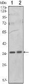 Anti-PPP1A antibody [6D1] used in Western Blot (WB). GTX82774