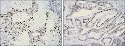 Anti-Ki67 antibody [8D5] used in IHC (Paraffin sections) (IHC-P). GTX82777