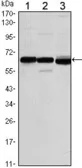 Anti-Estrogen Receptor alpha antibody [6B6] used in Western Blot (WB). GTX82778