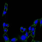 Anti-FAK antibody [10H7] used in Immunocytochemistry/ Immunofluorescence (ICC/IF). GTX82780