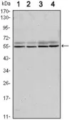 Anti-SMAD6 antibody [5H3] used in Western Blot (WB). GTX82781