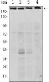 Anti-RICTOR antibody [4H5] used in Western Blot (WB). GTX82786