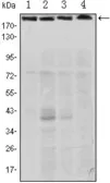 Anti-RICTOR antibody [4H5] used in Western Blot (WB). GTX82786