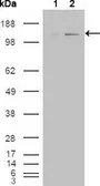 Anti-ABL2 antibody [1H1] used in Western Blot (WB). GTX82788