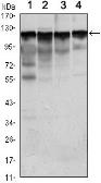 Anti-Hexokinase 1 antibody [3A10] used in Western Blot (WB). GTX82790