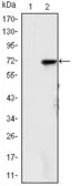 Anti-KDM4A antibody [5H1] used in Western Blot (WB). GTX82792