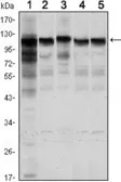 Anti-Hexokinase 1 antibody [7A7] used in Western Blot (WB). GTX82795