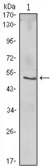 Anti-IKB beta antibody [7B4] used in Western Blot (WB). GTX82797
