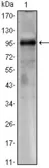 Anti-TORC1 antibody [1B5] used in Western Blot (WB). GTX82805