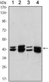 Anti-PRMT6 antibody [4G2] used in Western Blot (WB). GTX82806