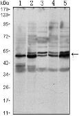 Anti-SMAD3 antibody [5G11] used in Western Blot (WB). GTX82809