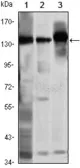 Anti-SMC1 antibody [5B6] used in Western Blot (WB). GTX82813