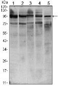 Anti-STAT6 antibody [7D3] used in Western Blot (WB). GTX82814