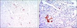 Anti-KLHL13 antibody [8D1] used in IHC (Paraffin sections) (IHC-P). GTX82815