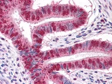 Anti-EXPAND1 / MUM1 antibody [4G10] used in IHC (Paraffin sections) (IHC-P). GTX82832