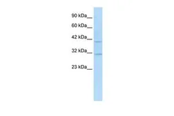 Anti-SIRT6 antibody, N-term used in Western Blot (WB). GTX82851