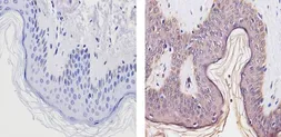 Anti-Thyroid Hormone Receptor alpha-2 antibody used in IHC (Paraffin sections) (IHC-P). GTX82858