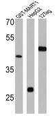 Anti-GST tag antibody used in Western Blot (WB). GTX82896