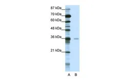 Anti-MBD2 antibody, Internal used in Western Blot (WB). GTX82965