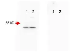 Anti-beta Amyloid antibody used in Western Blot (WB). GTX82974
