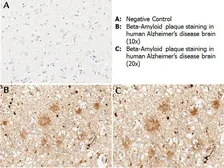 Anti-beta Amyloid antibody used in IHC (Paraffin sections) (IHC-P). GTX82974