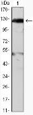 Anti-JAK2 antibody [1C1] used in Western Blot (WB). GTX82993