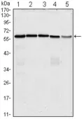 Anti-CDC25C antibody [1F12] used in Western Blot (WB). GTX82998