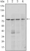 Anti-Blimp1 antibody [5E7] used in Western Blot (WB). GTX83001
