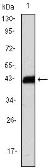 Anti-CD3 zeta antibody [4B10] used in Western Blot (WB). GTX83004