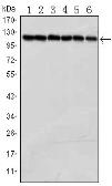 Anti-PARP antibody [7A10] used in Western Blot (WB). GTX83005