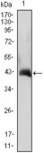 Anti-GM-CSF antibody [3D3] used in Western Blot (WB). GTX83008
