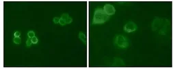 Anti-TYRO3 antibody [6D6F10] used in Immunocytochemistry/ Immunofluorescence (ICC/IF). GTX83010