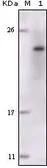 Anti-FES antibody [5A11G5] used in Western Blot (WB). GTX83011