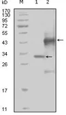 Anti-EphA4 antibody [7D3D4] used in Western Blot (WB). GTX83018