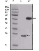 Anti-Src antibody [5D10C4] used in Western Blot (WB). GTX83021
