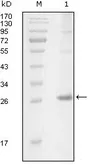 Anti-ITK antibody [5G12C4] used in Western Blot (WB). GTX83023