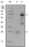 Anti-Syk antibody [8C1A3] used in Western Blot (WB). GTX83029