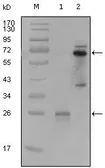 Anti-Syk antibody [8C1A3] used in Western Blot (WB). GTX83029