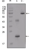 Anti-IGFBP2 antibody [1F6F6] used in Western Blot (WB). GTX83035