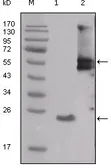 Anti-Src antibody [4F1E8] used in Western Blot (WB). GTX83037