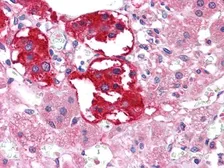 Anti-EphB3 antibody [4A122D1] used in IHC (Paraffin sections) (IHC-P). GTX83041