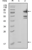 Anti-Visfatin antibody [1D3A12] used in Western Blot (WB). GTX83046
