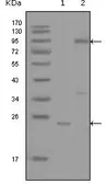 Anti-c-Yes antibody [2F3E6] used in Western Blot (WB). GTX83048