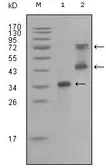 Anti-Ret antibody [6E4C4] used in Western Blot (WB). GTX83055