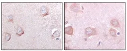 Anti-SorLA antibody [3B6B11] used in IHC (Paraffin sections) (IHC-P). GTX83063