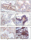 Anti-IGF1R beta antibody [3C8B1] used in IHC (Paraffin sections) (IHC-P). GTX83067