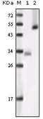 Anti-GSK3 alpha antibody [6G12C2] used in Western Blot (WB). GTX83071