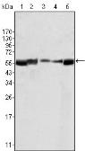 Anti-LYN antibody [2H8D7] used in Western Blot (WB). GTX83072