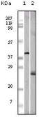 Anti-Apolipoprotein M antibody [10C3G5] used in Western Blot (WB). GTX83082