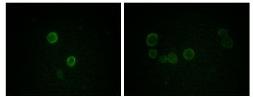 Anti-Apolipoprotein M antibody [8F12C6B8] used in Immunocytochemistry/ Immunofluorescence (ICC/IF). GTX83083